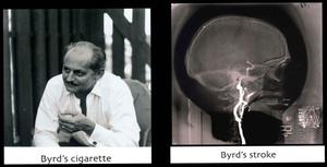 [Diptych of Byrd III and his brain scan]