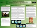 Thumbnail image of item number 1 in: 'Very Early Onset Schizophrenia: Gray Matter Development in Neonate Brain Tissue'.