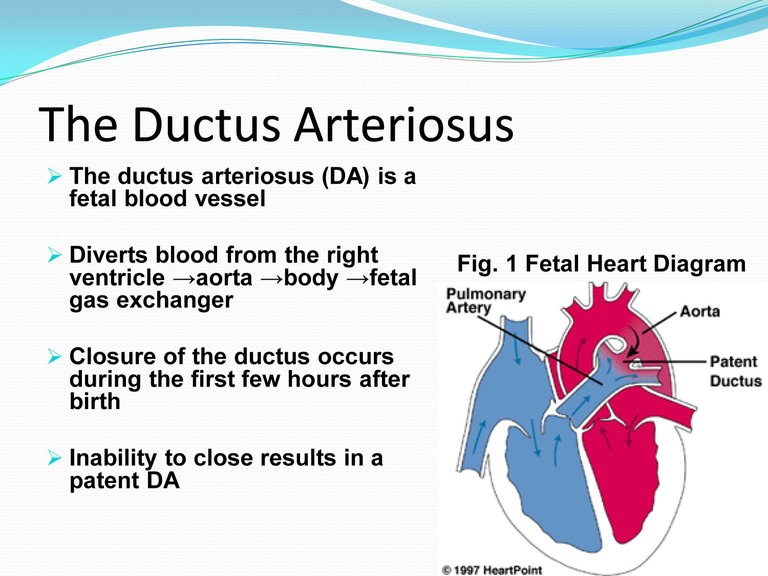 Fetal Ductus Arteriosus